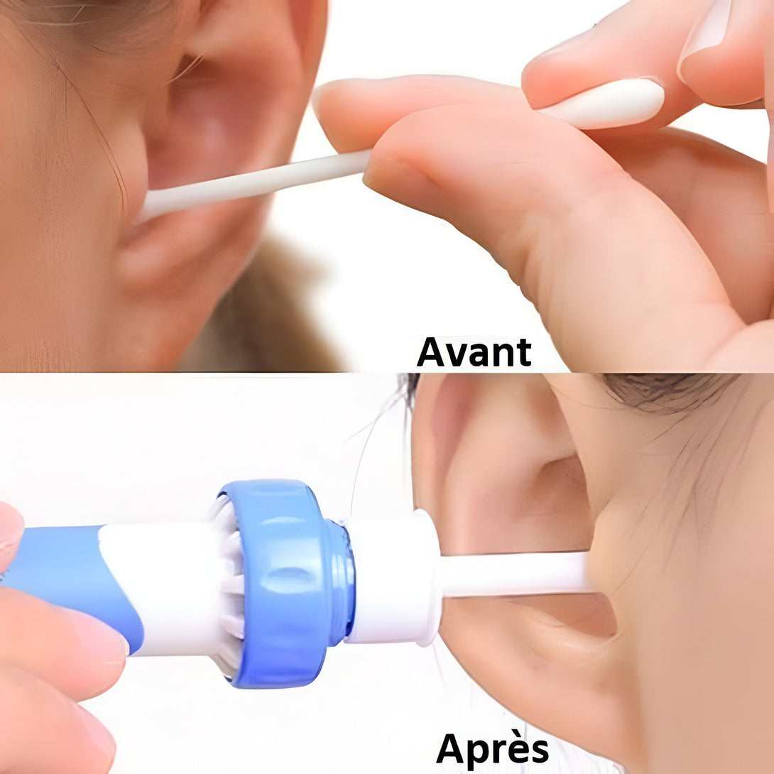 Aspirateur Cerumen Femme: Nettoyage Oreilles Doux
